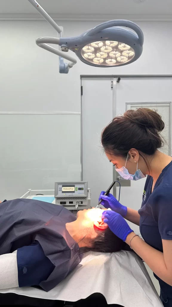 Surgitron treatment