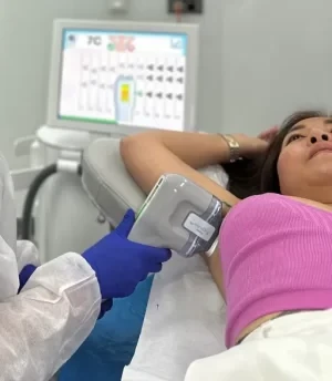 MiraDry treatment