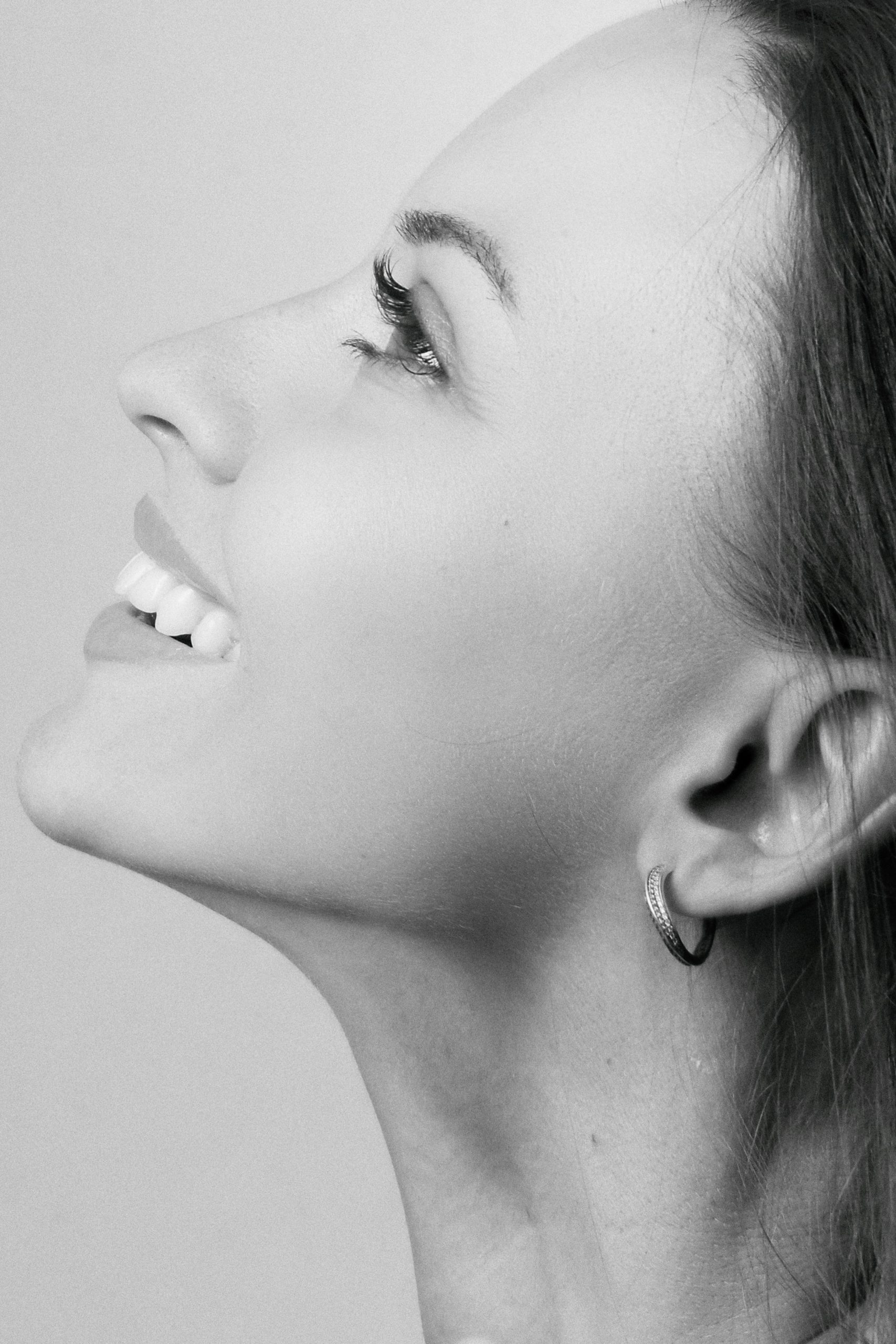 Smile lines forming a dynamic wrinkle pattern
